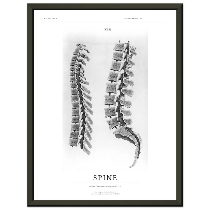 SPINE 1733 — Anatomy Archive Framed Art Print · 30 × 40 cm